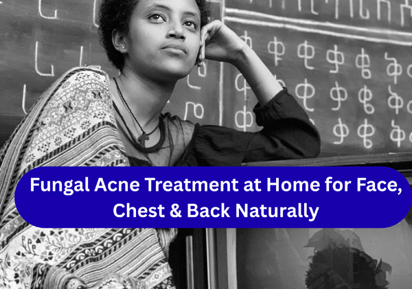 Fungal Acne Treatment at Home for Face, Chest & Back Naturally