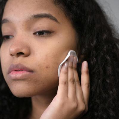 Teen Skin Care: Clear Skin Confidence Starts Here